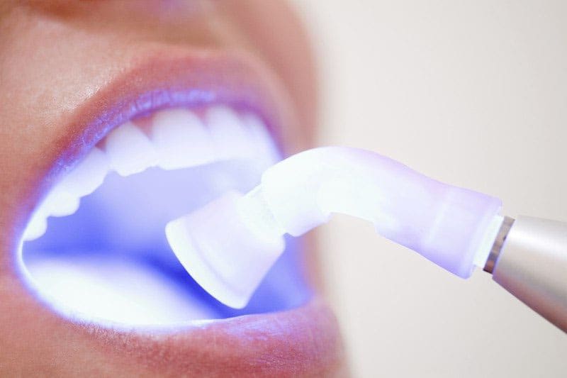 Laser Dental Treatment Hinjewadi