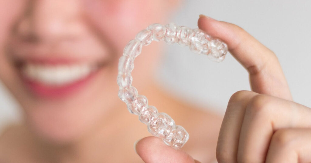 Invisalign The Magic Of Invisible Braces OM Happy Teeth