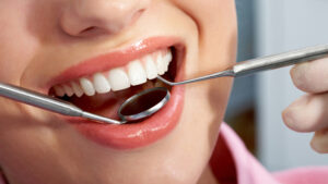 teeth cleaning in hinjewadi pune