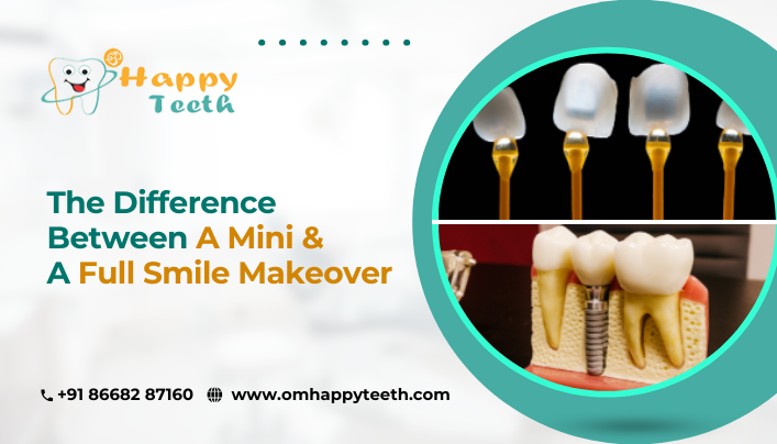 The Difference Between a Mini and a Full Smile Makeover