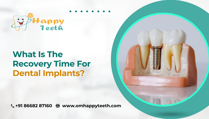 What is the Recovery Time for Dental Implants?