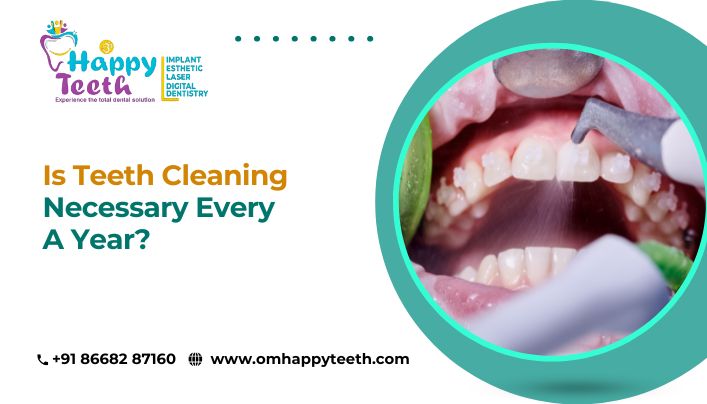 Is Teeth Cleaning Necessary Every Year?
