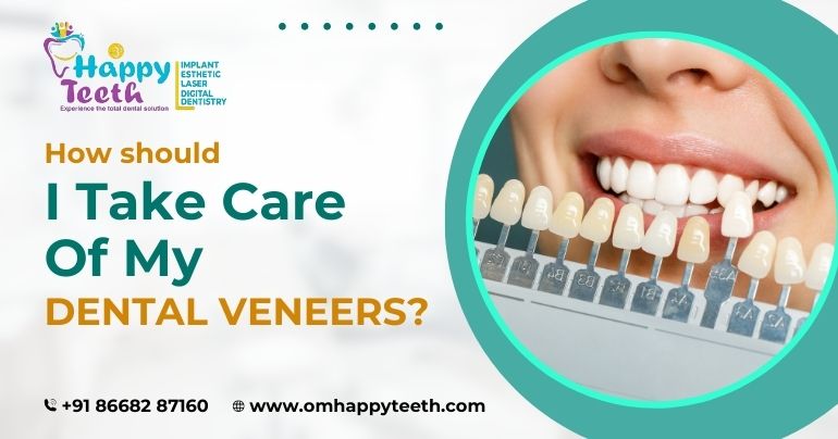 How Should I Take Care of My Dental Veneers?