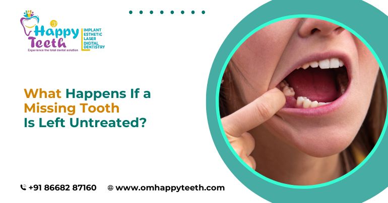 What Happens If a Missing Tooth Is Left Untreated?
